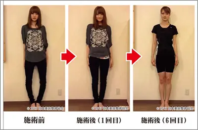 施術による変化